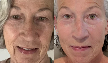 Joan, 64 años